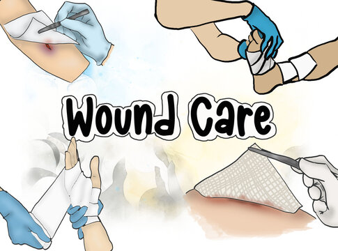 Wound Care: Best Practices